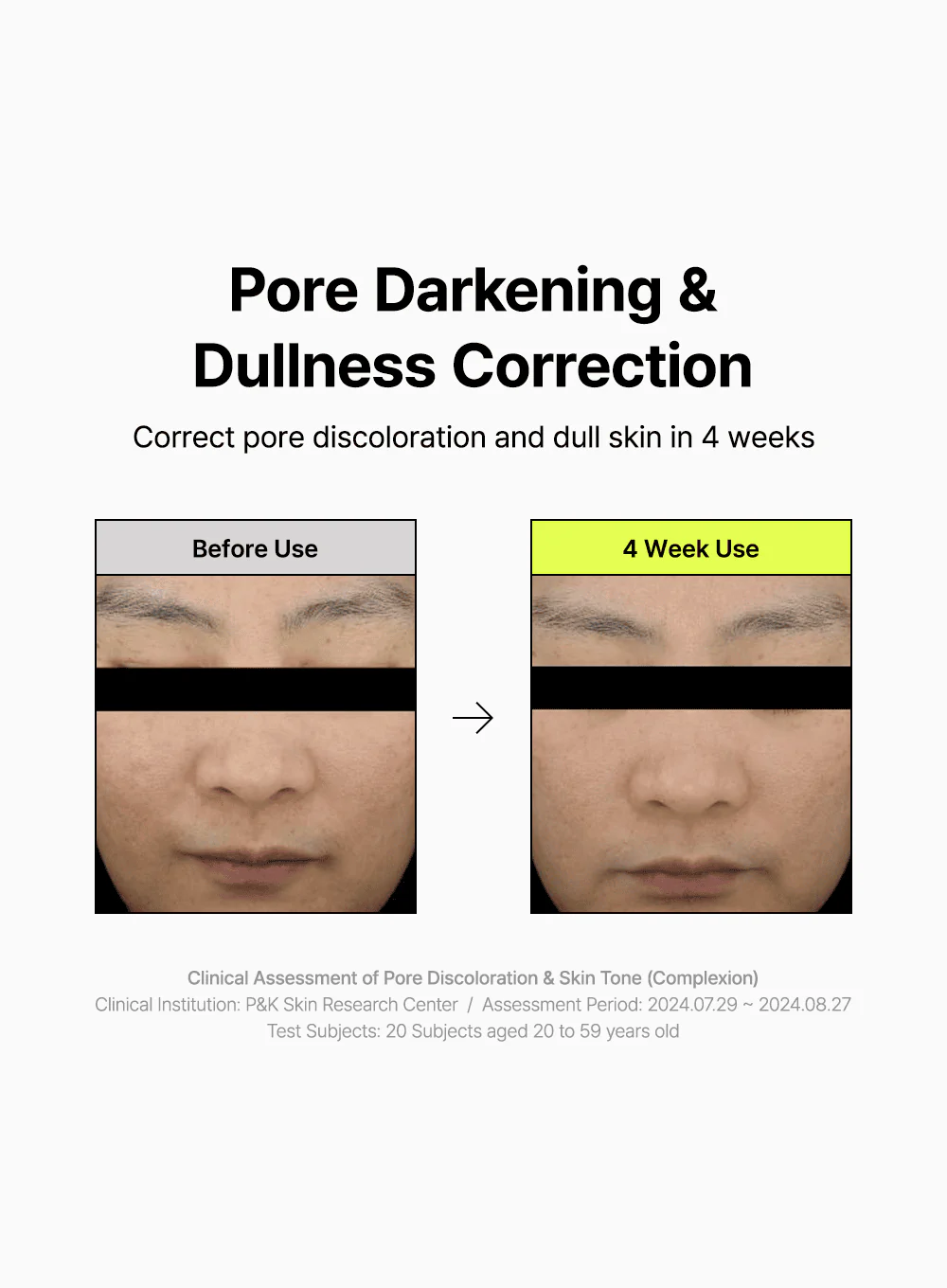 Pore Smoothing Bakuchiol Serum (30ml) - Image 6